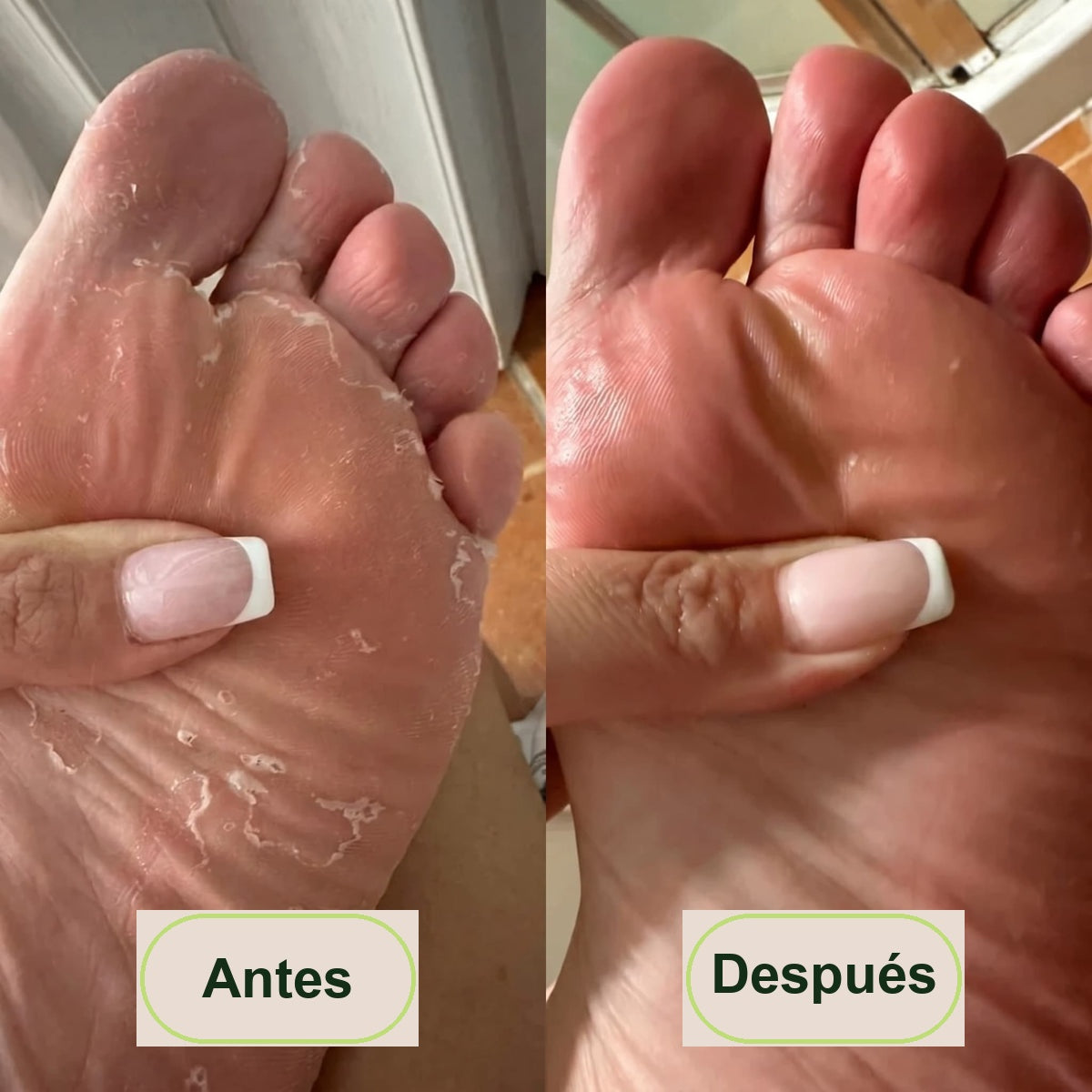 Antes y después - piel de la planta del pie