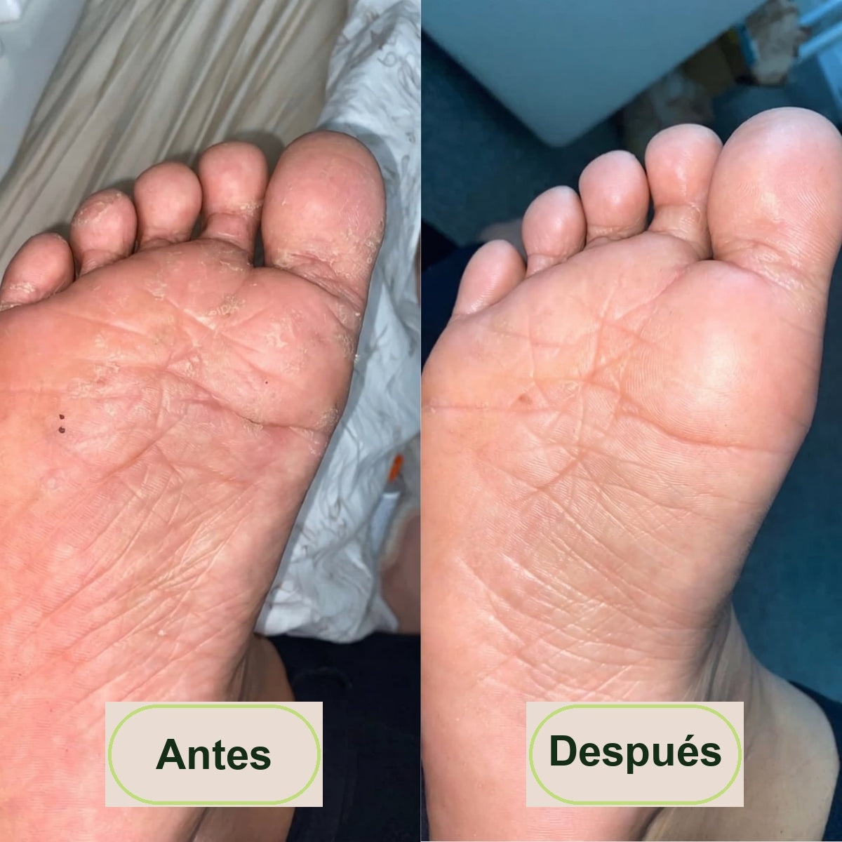 Antes y después - resultado tras el uso regular