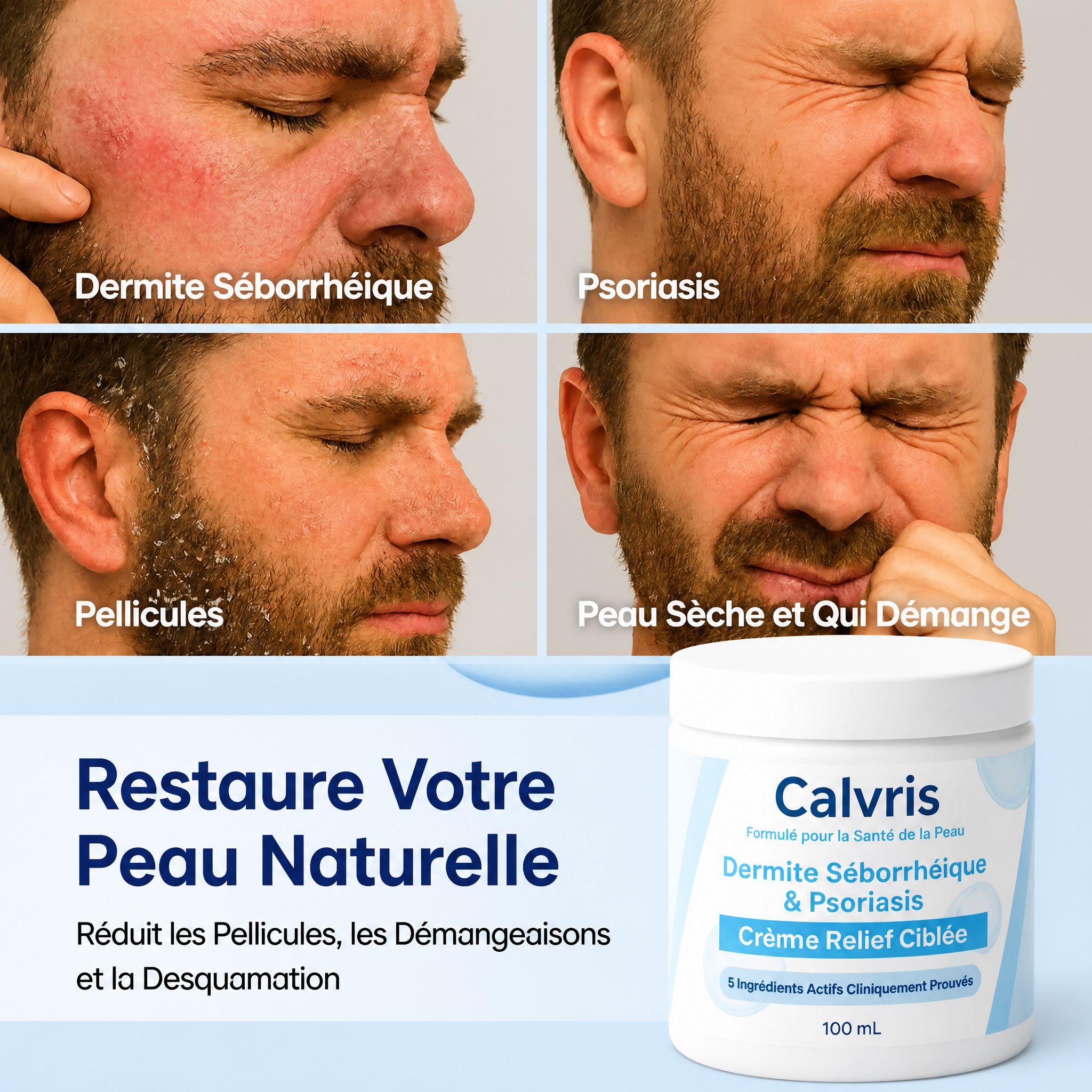 Quatre problemes de peau